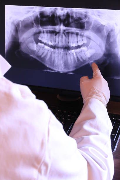 Best Emergency Tooth Extraction in North Haverhill, NH