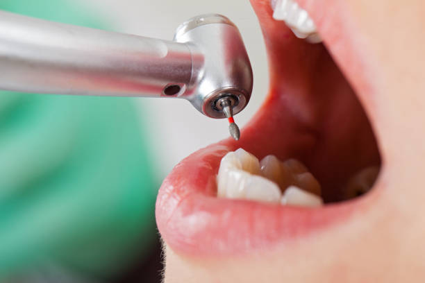 Best Same-Day Emergency Dentist in North Haverhill, NH